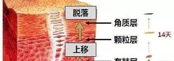 去角质的原理是什么，有什么方法？_橡皮擦祛斑